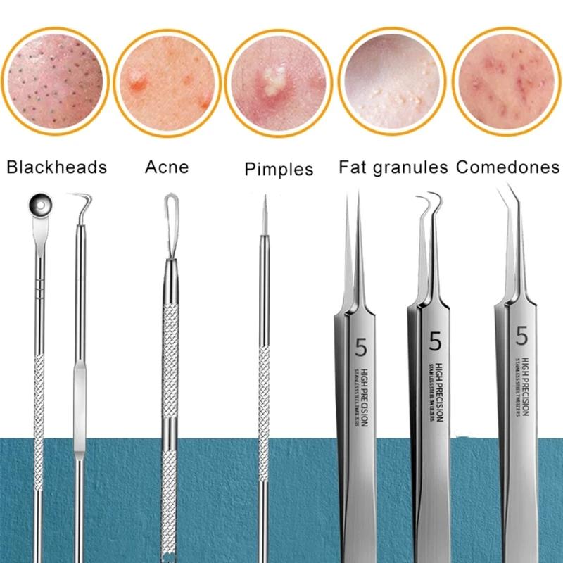 3-8pcs Acne Needle Remove Blackhead Comedone Extractor Tools Stainless Steel Facial Skin Care Tool Pimple Blemish Removal Tools