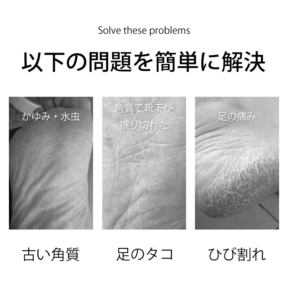 Heel Callus Foot Callus Heel Heel Made of Heel Storage Case Clear Remover, Remover, Care, File, Nano-glass, Care, Washable, Included,