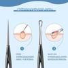 Stainless Steel Acne Needles for Blackhead Pore Acne Blackhead Dedicated Pore Care Beauty Set Removal, Care, Removal, Removal, Portable, Kit, Tool,