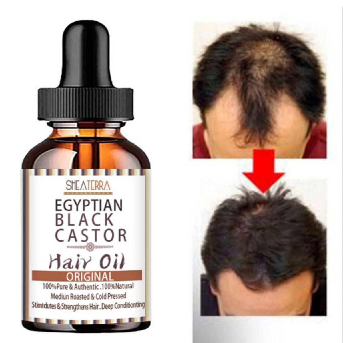 

Натуральное эфирное масло для быстрого роста волос, средство против выпадения волос, эссенция для роста волос, лечение алопеции для женщин