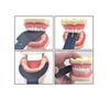 Dental Orthodontic Black Background Board Photo Image Contrast Oral Cheek Plate with Scale Mark Autoclavable Tools