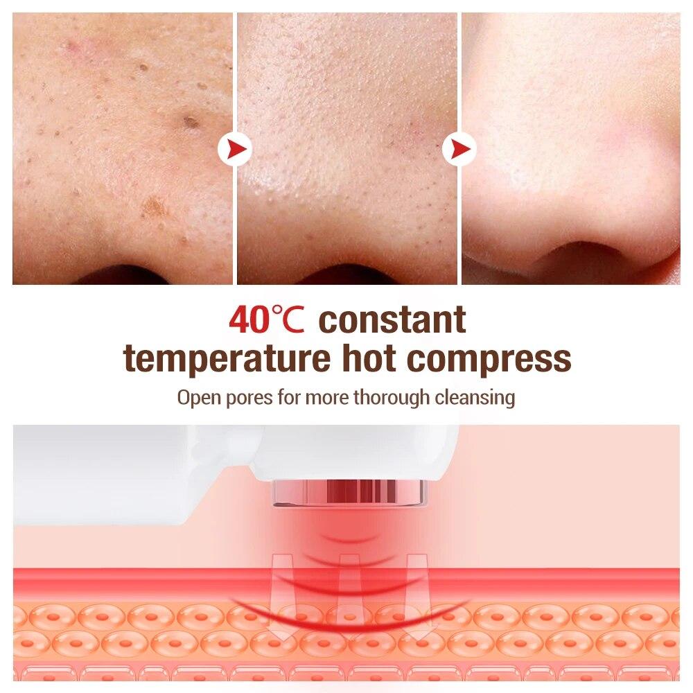 Water Cycle Blackhead Remover Hot Compress Pore Cleaner Vacuum Suction For Acne Pimple Black Dot Removal Skin Care Tools