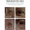 O'CHEAL Retinol Eye Cream Moisturising Fade Dark Circles Brightening Improve Fine Lines Essence Eye Cream