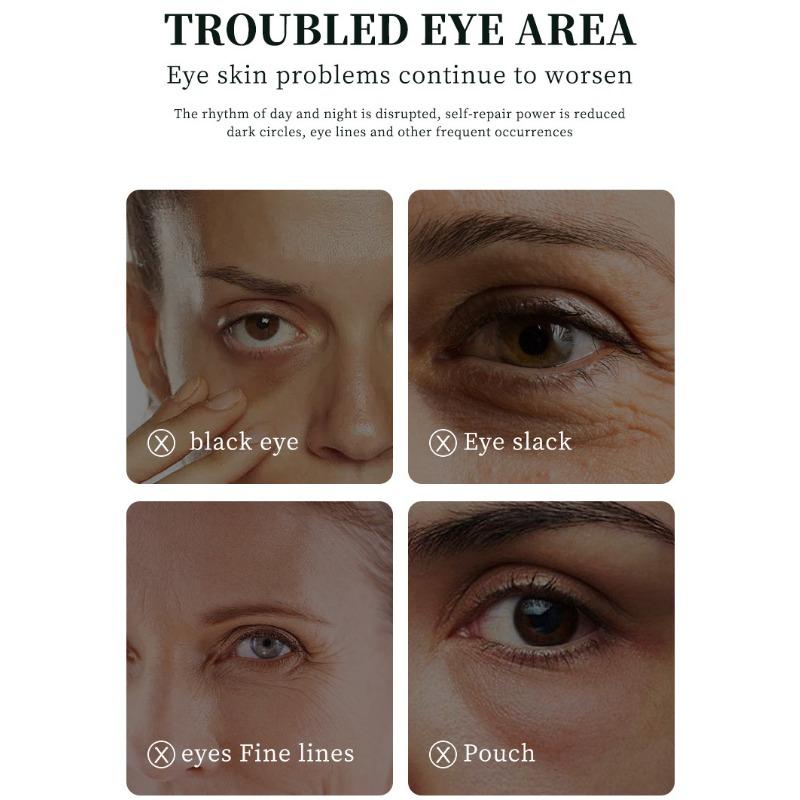O'CHEAL Retinol Eye Cream Moisturising Fade Dark Circles Brightening Improve Fine Lines Essence Eye Cream