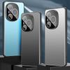 Acrylic Back, Metal Camera Protection Phone Case For Honor Power Honor GT Honor 300 Pro 200 Pro 100 90 Lens Protection Cover