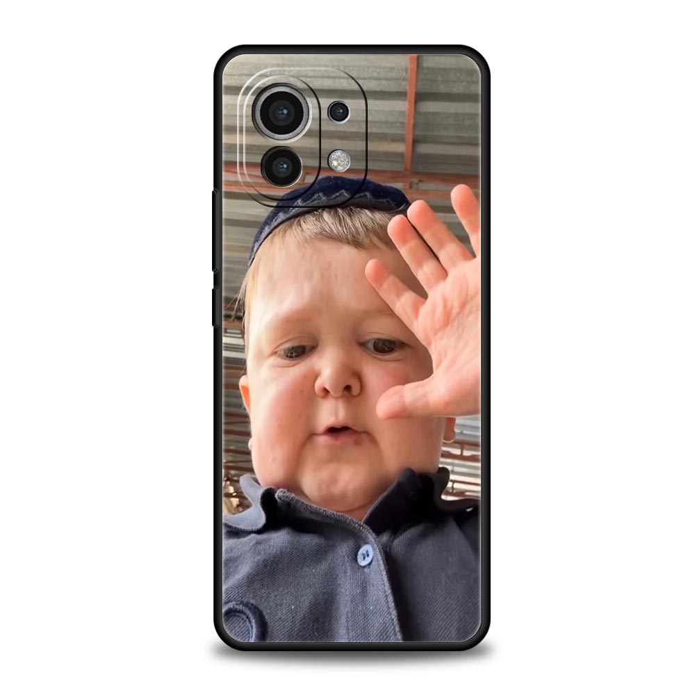 Funny Babaite Hasbulla Phone Case For Xiaomi Mi 17 15T 15 14 14T 13T 12T Pro 12 13 Lite 5G 11T Poco X6 X7 X5 Pro Soft Cover