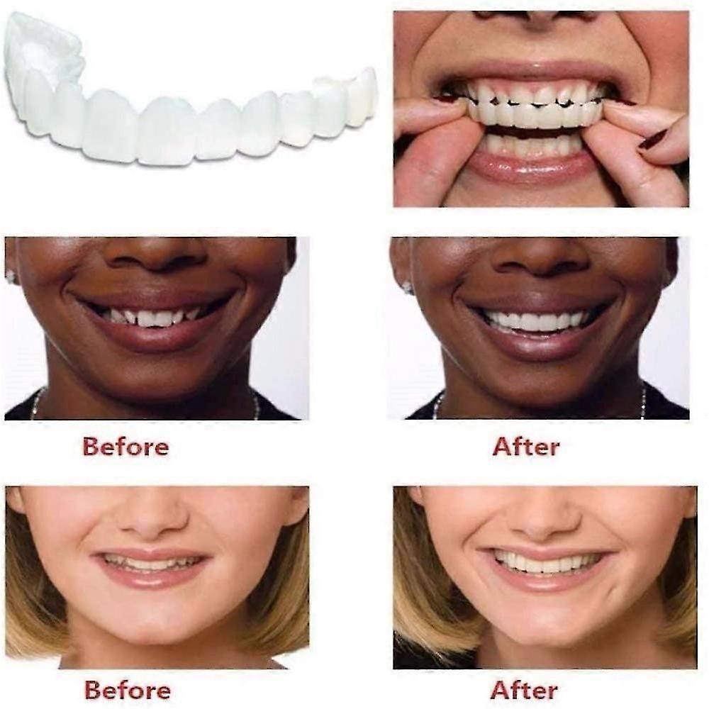 Instant Veneers Dentures Fake Teeth Braces Whitening Cosmetic Tooth Covering Snap on Smile Teeth Top and Bottom Clip