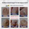 Nail Fungus Repair Solution