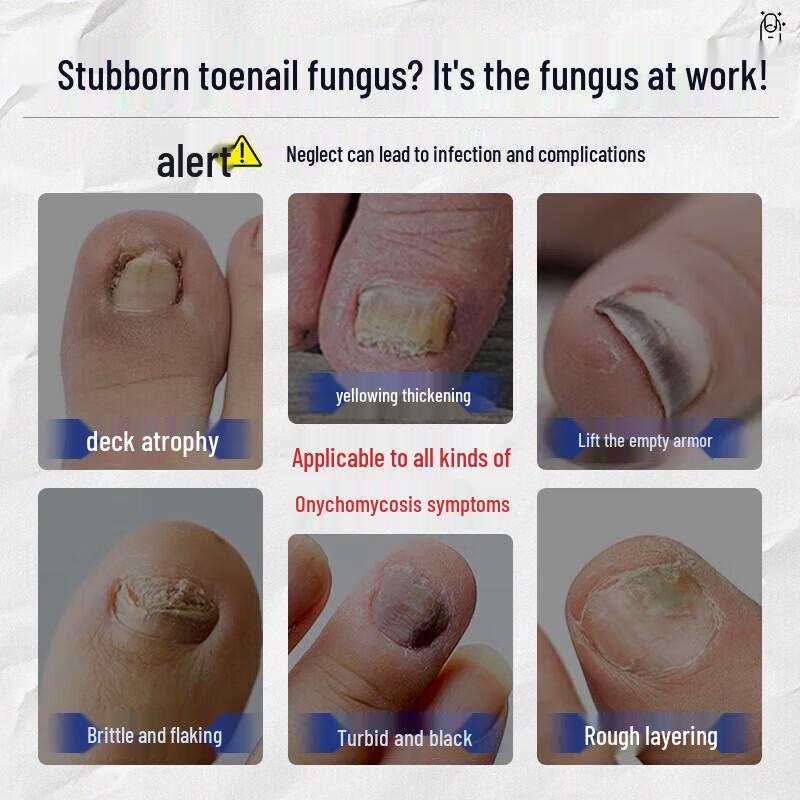 Nail Fungus Repair Solution