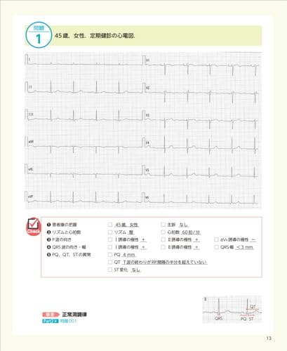 160 ECG Questions & Thorough Explanations To Pass Level 2 & 3 Exams - Get Stronger for the Actual Exam with Randomly Selected Practice Questions and P