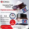 Renhe Jiangxin Salicylic Acid Acne Treatment Lotion
