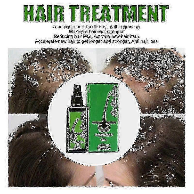 120ml Thailand Neo Hair Lotion Serum Essence Anti Hair Loss Treatment Hair Beard Growth For Men Women  Spray Oil Kit