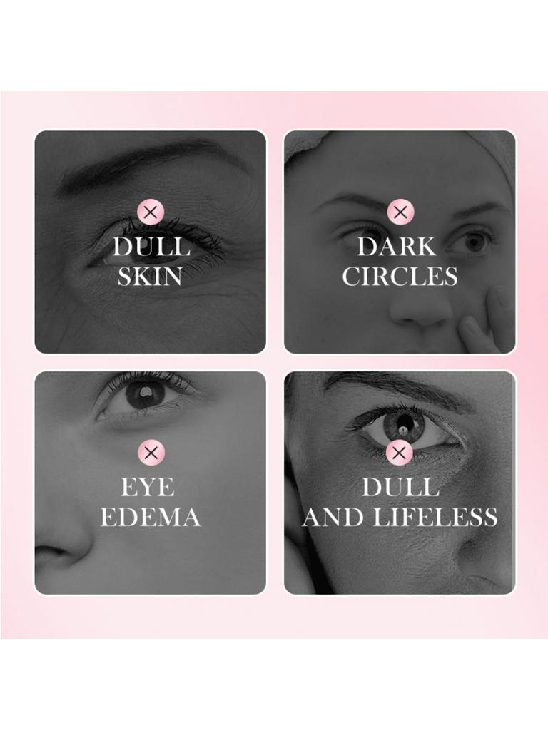 Rose Eye Mask Plant Essence Moisturizes Eyes, Brightens Skin, Moisturizes and Tightens Eyes