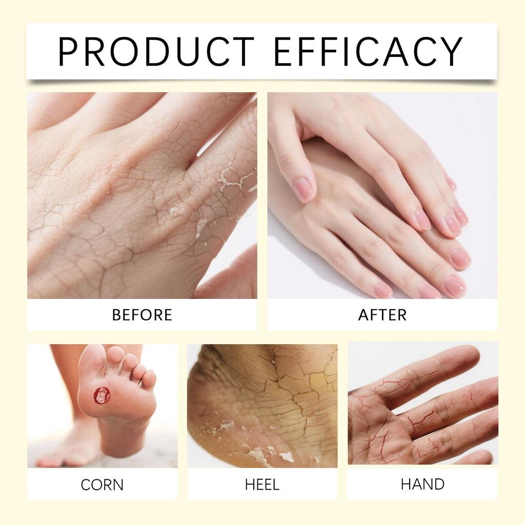 AMZ Urea Hand and Foot Moisturizing Cream: Hydrating and Nourishing / Heel Care / Softening Cuticles / Exfoliating Moisturizer