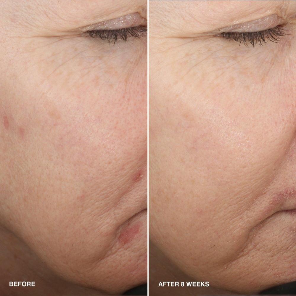 Bobbi Brown vyhlazující sérum obohacené o vitamíny s niacinamidem 1,01 oz