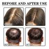 3x Hair Growth Products Ginger Extract Growing Hair Essential Oil Beauty Hair Care Prevent Hair Loss Oil Scalp Treatment For Men Women