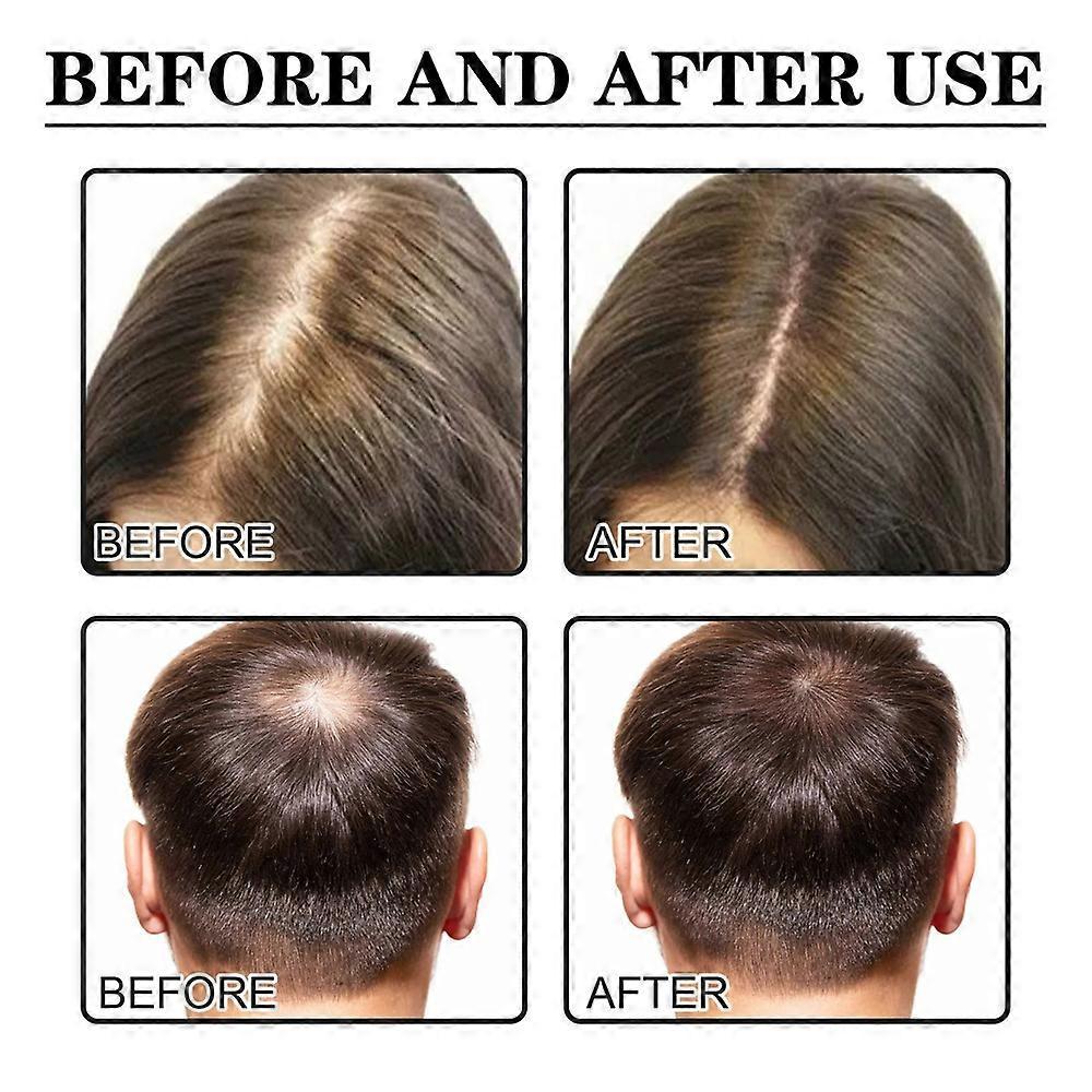 3x Hair Growth Products Ginger Extract Growing Hair Essential Oil Beauty Hair Care Prevent Hair Loss Oil Scalp Treatment For Men Women