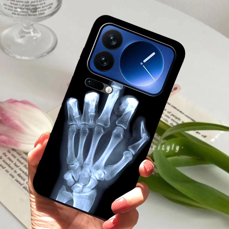 For Xiaomi Mi 17 Pro Max/17Pro Case Fashion Shockproof Protective Back Cover For Xiaomi 17 ProMax Soft TPU Silicone Phone Fundas
