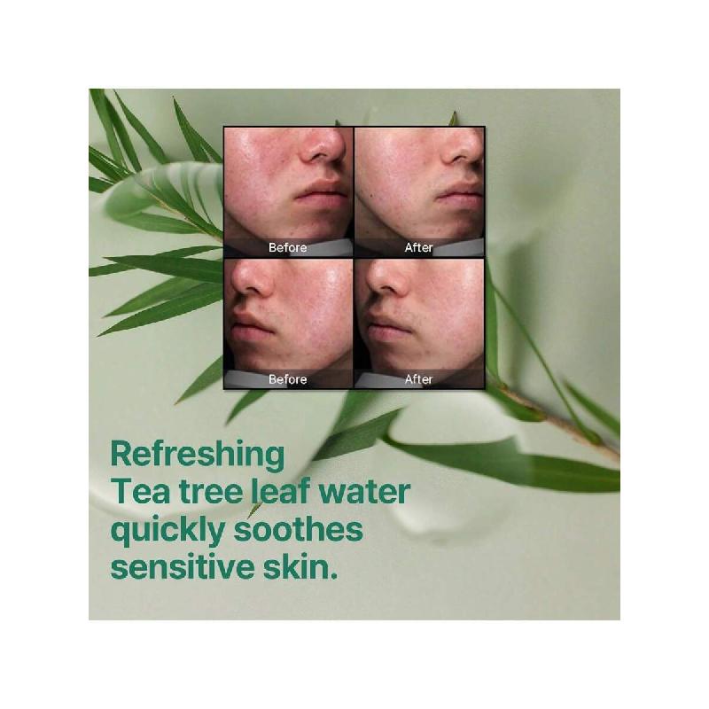 SOME BY MI Cremă miraculoasă AHA BHA PHA 30 Days 60ml - Cremă hidratantă exfoliantă ușoară cu acid salicilic și centella pentru toate tipurile de ten - Calmare zilnică