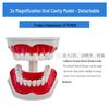 Large Kindergarten Oral Health Toothbrushing Model for Early Education