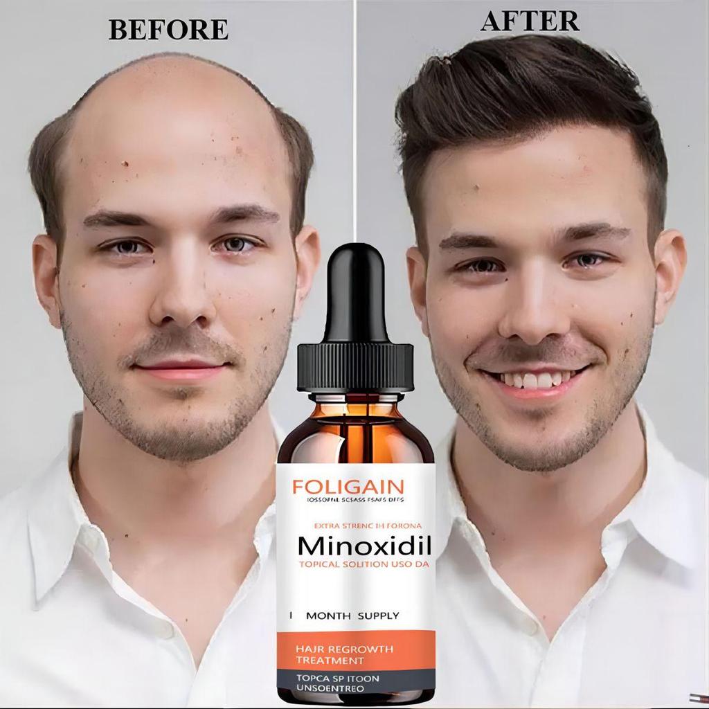 Liquide de soin hydratant pour la croissance des cheveux Favorise la croissance des cheveux, prévient la chute des cheveux, épaissit les cheveux Huile essentielle de soin
