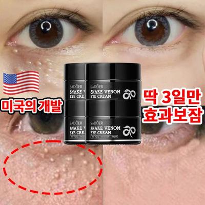 1+1 US Augencreme, Fettentfernungscreme, Augenringe, Tränensäcke, Tränensäckecreme, Faltenverbesserungskollagen, 30g, 4 Stück