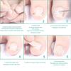 1/2 Set Ingrown Toenail Corrector Tools Pedicure Recover Embed Toenail Treatment Professional Foot Care Correction Tool