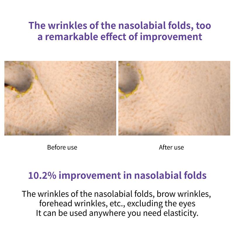 Vari:Hope Biotics Vital Augencreme 20 ml