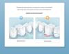 Portable Smart Electric Water Flosser for Teeth Cleaning
