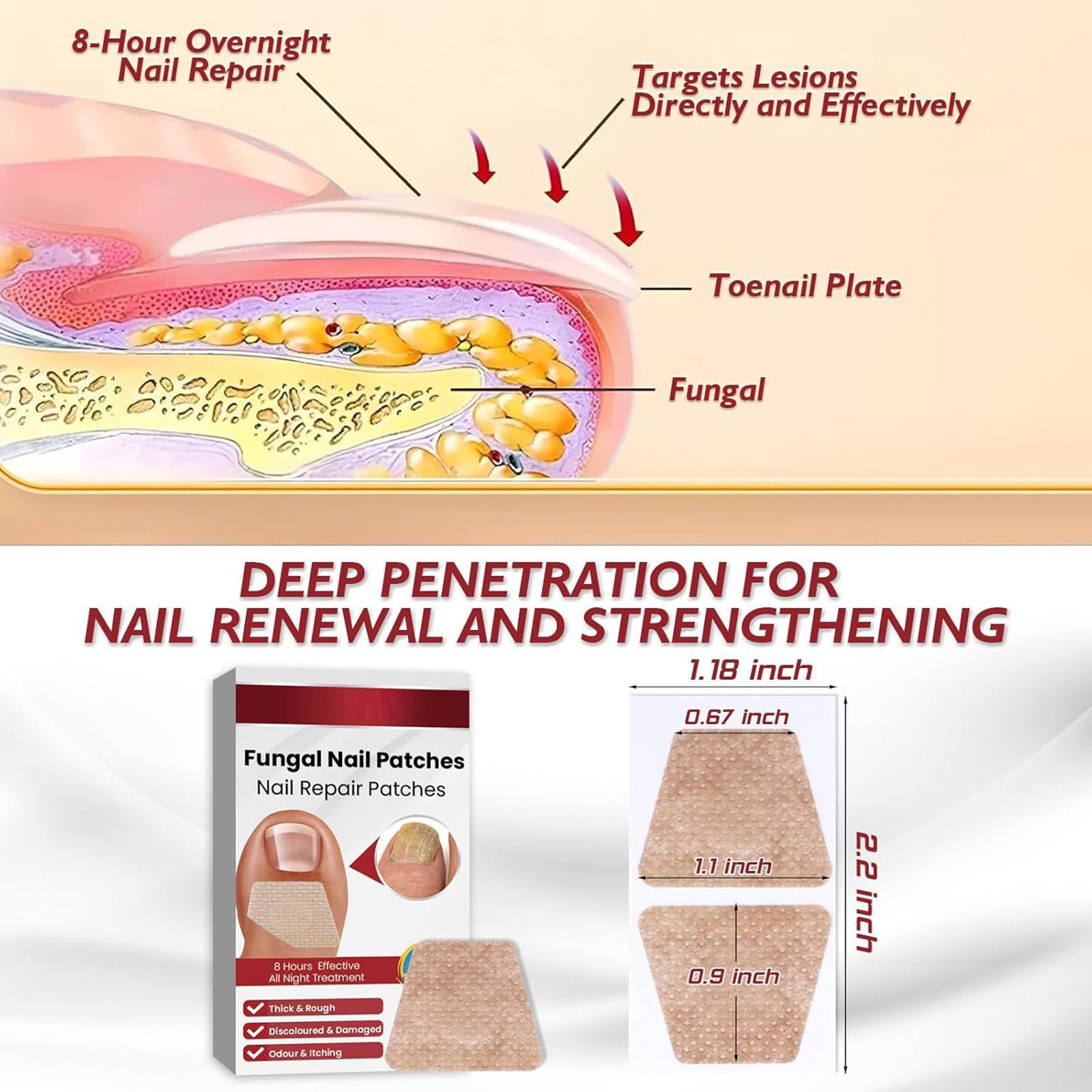

Патч для ухода за ногтями, Мягкий ноготь на руках и ногах, Вросший ноготь Утолщающий тип Яркий ноготь Онихомикоз Очищающий патч для ногтей One Size белый