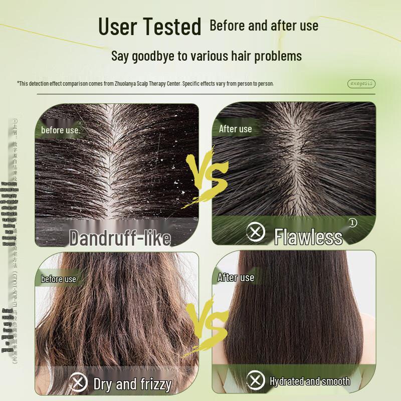 Zhuolanya Ginger Anti-Dandruff Shampoo