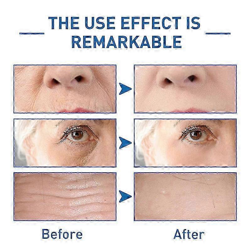 3Pcs Anti-Aging Hyalu B5 Serum Anti-wrinkle Concentrate Repairing Serum 30ml