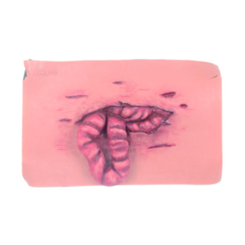 AWR Abdominal Evisceration Trauma Kit