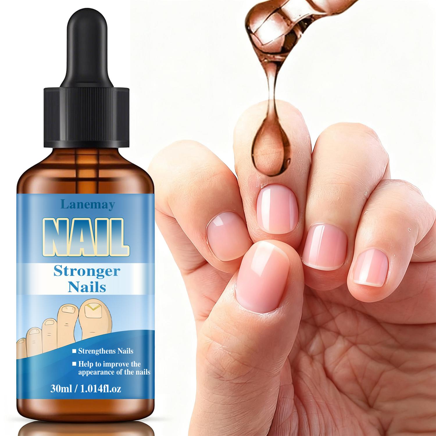 

Nail Oil-Promote Nail Growth-Strengthens Nails For Healthy Growth-Eliminates Harmful Germs-30ml