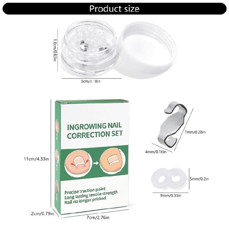 Stainless Steel Lever Hook Ingrowns Toenail Tool Elastic Bands Adjustable Corrector For Men And Women