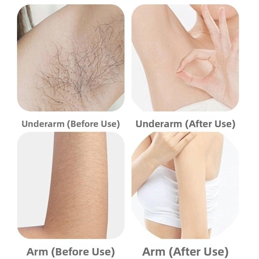 Painless Hair Removal Machine Safety Portable Electric Shaver Waterproof Without Black Spots Painless Epilator for Female Bikini