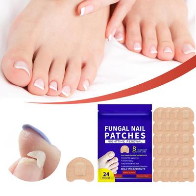 Manicure – Neglepleje