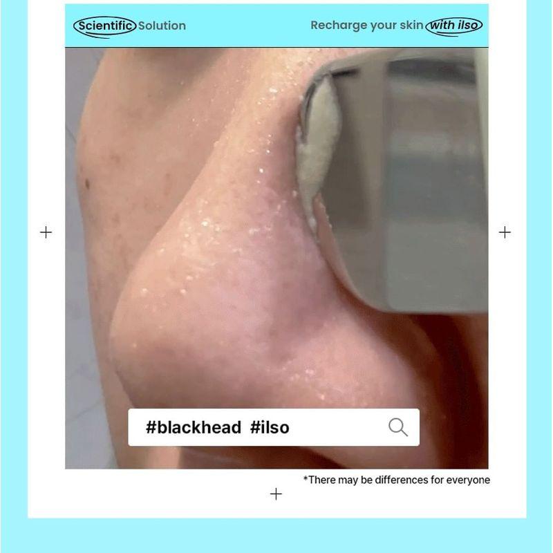 ilso - Super Melting Sebum Softener Special Set