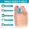 6 Pairs Silicone Toe Separators Relief Bunion Pain Toes Corrector Stretcher Pad Blue White
