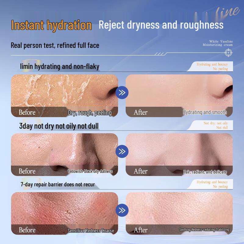 Dongyang Zhihua Vaseline Anti-Aging Face Cream