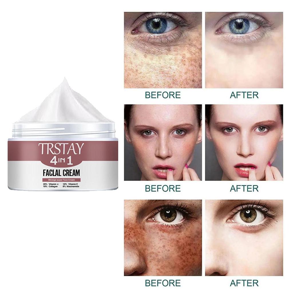 Moisturizing Face Cream Improves Dryness and Water Shortage. Adequate, Delicate, Moisturizing, Activating, and Caring for the Skin