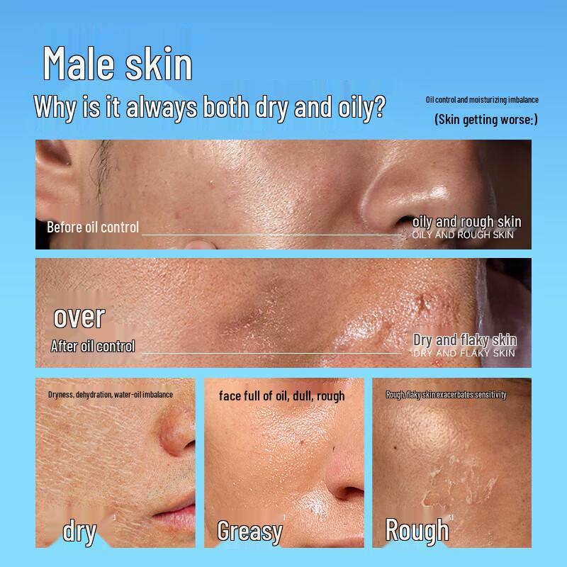 Zuo Yan You Se Oil Control Pore Cleansing Set