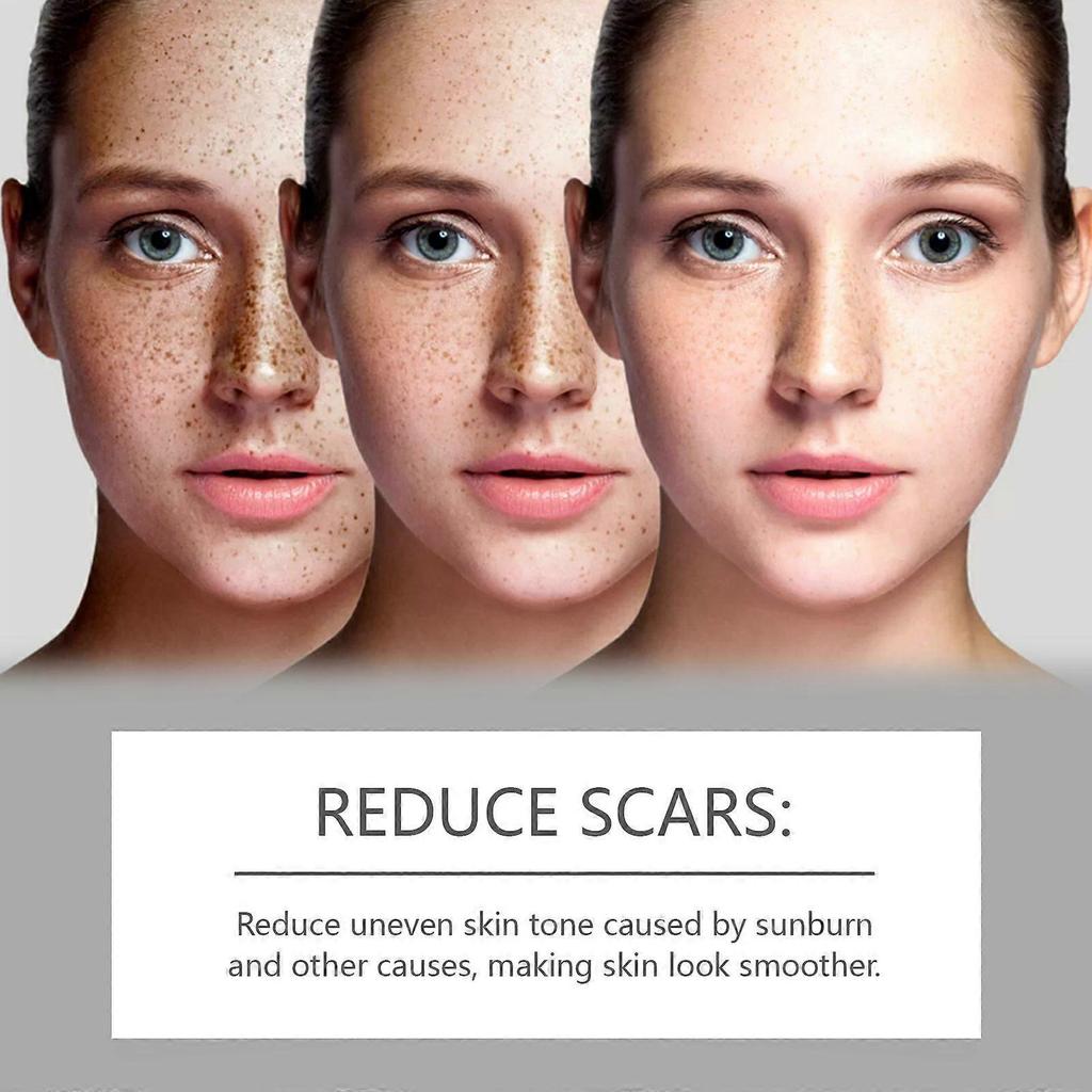 Limited time!!West Month Skin Repair Serum - Gently Moisturizes Facial Skin, Improves Dullness, Brightening Skincare Essence
