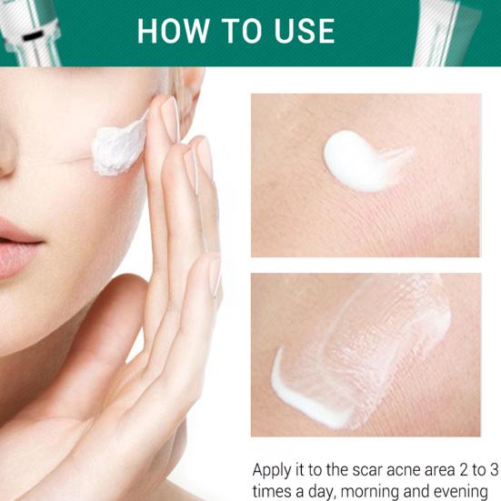 Breylee Acne Scar Removal Cream Stretch Marks Treatment Repairing Skin Care