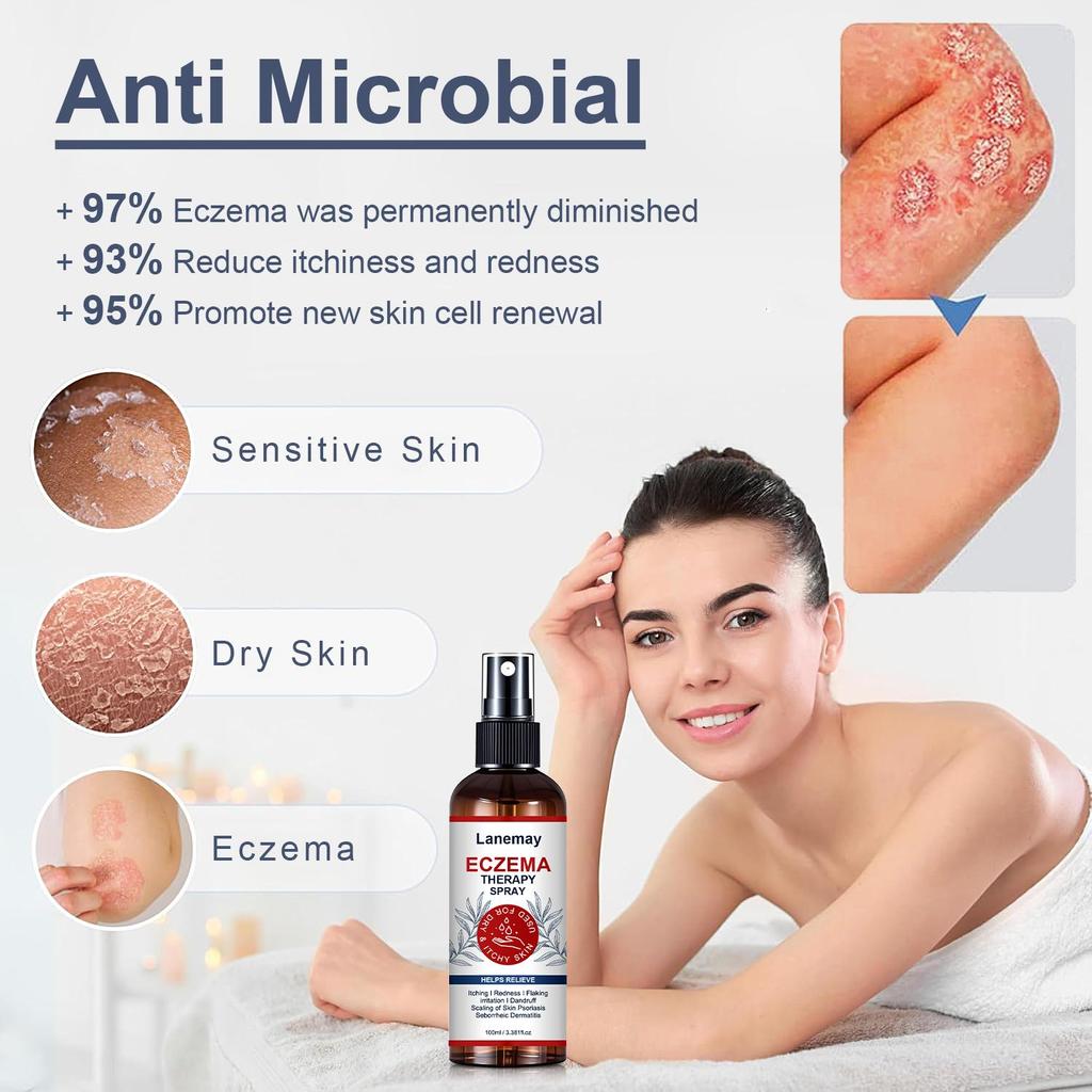 Eczema Therapy Spray-Eczema Treatment-Reduce Itchness And Redness-Prompte New Skin Cell Renewal, 100ml