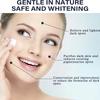 Whitening Freckle Cream Remove Melasma Cream Remove Dark Spots Anti Wrinkles Brighten Moisturizing Skin Care for Unisex