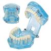Dental Pathological Model Clear Teaching Detachable Dental Teeth Display Model Blue Transparent