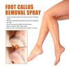 Nourishing Ouhoe Foot Spray For Softening Calluses And Cracked Heels 30ml
