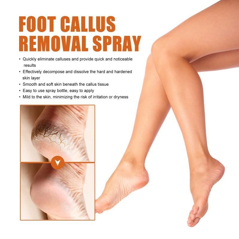 Nourishing Ouhoe Foot Spray For Softening Calluses And Cracked Heels 30ml