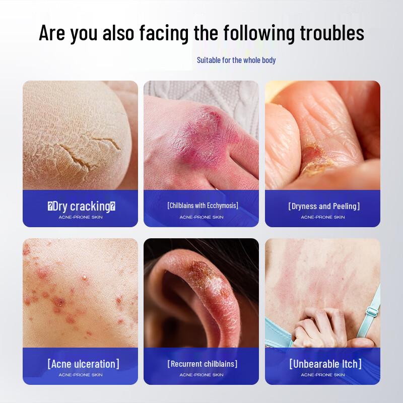 Xin Xile Cracked Skin Repair & Moisturizing Cream